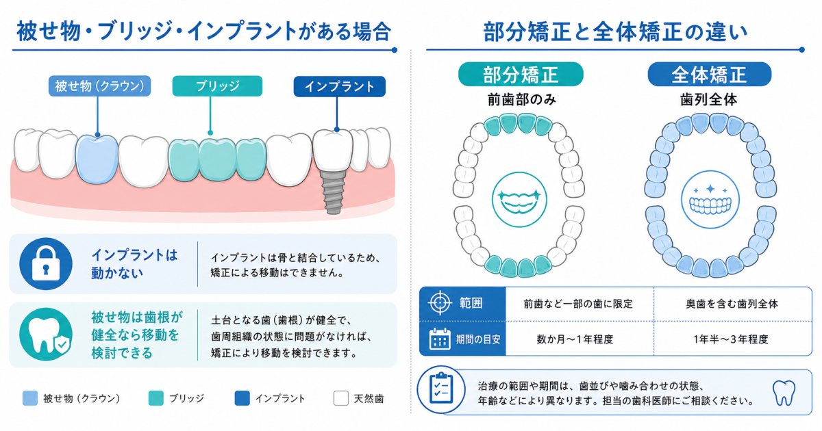 大人が歯列矯正をスタートするための3つの主要な判断基準